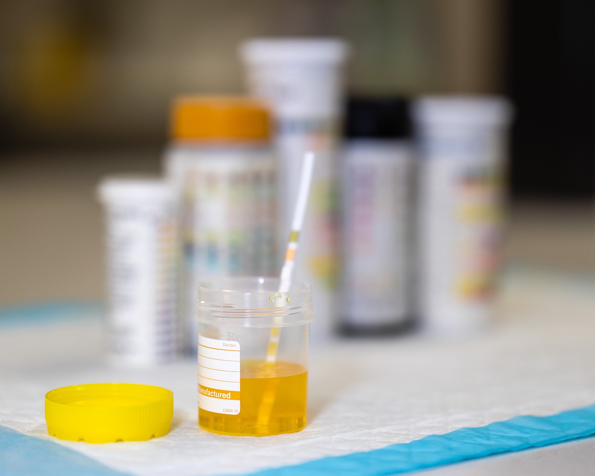 Urine analysis and urinary test using a dipstick in a laboratory.